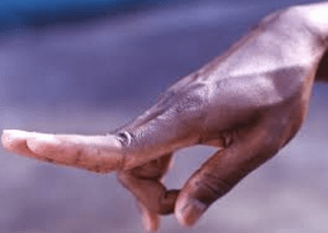 No wonder Pedro Martinez had such nasty movement. 